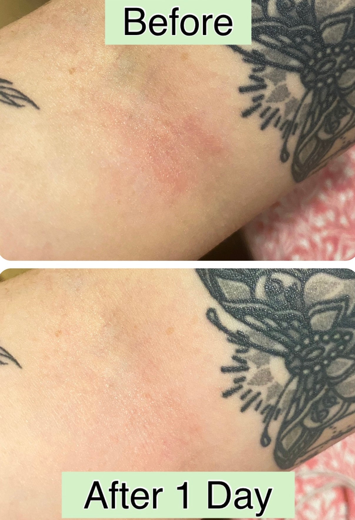 Natural Collagen & Hyaluronic Acid Cream